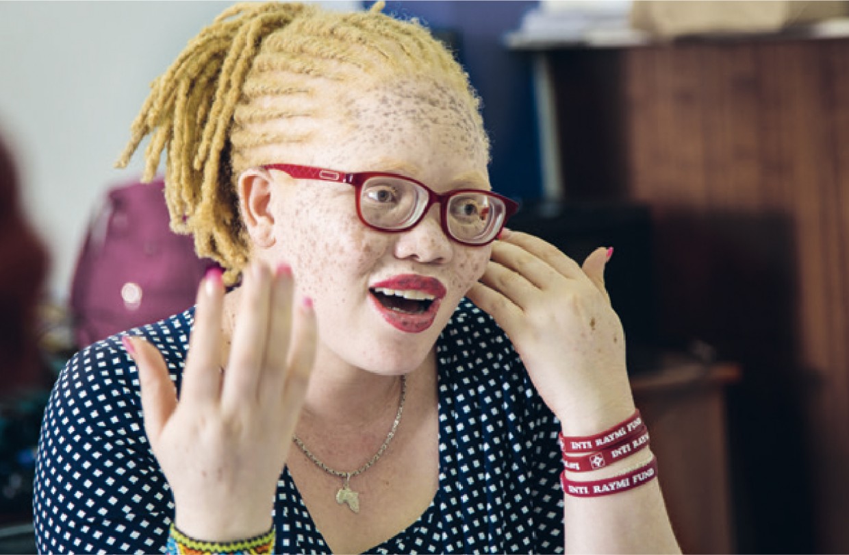 Albinism in Kenya